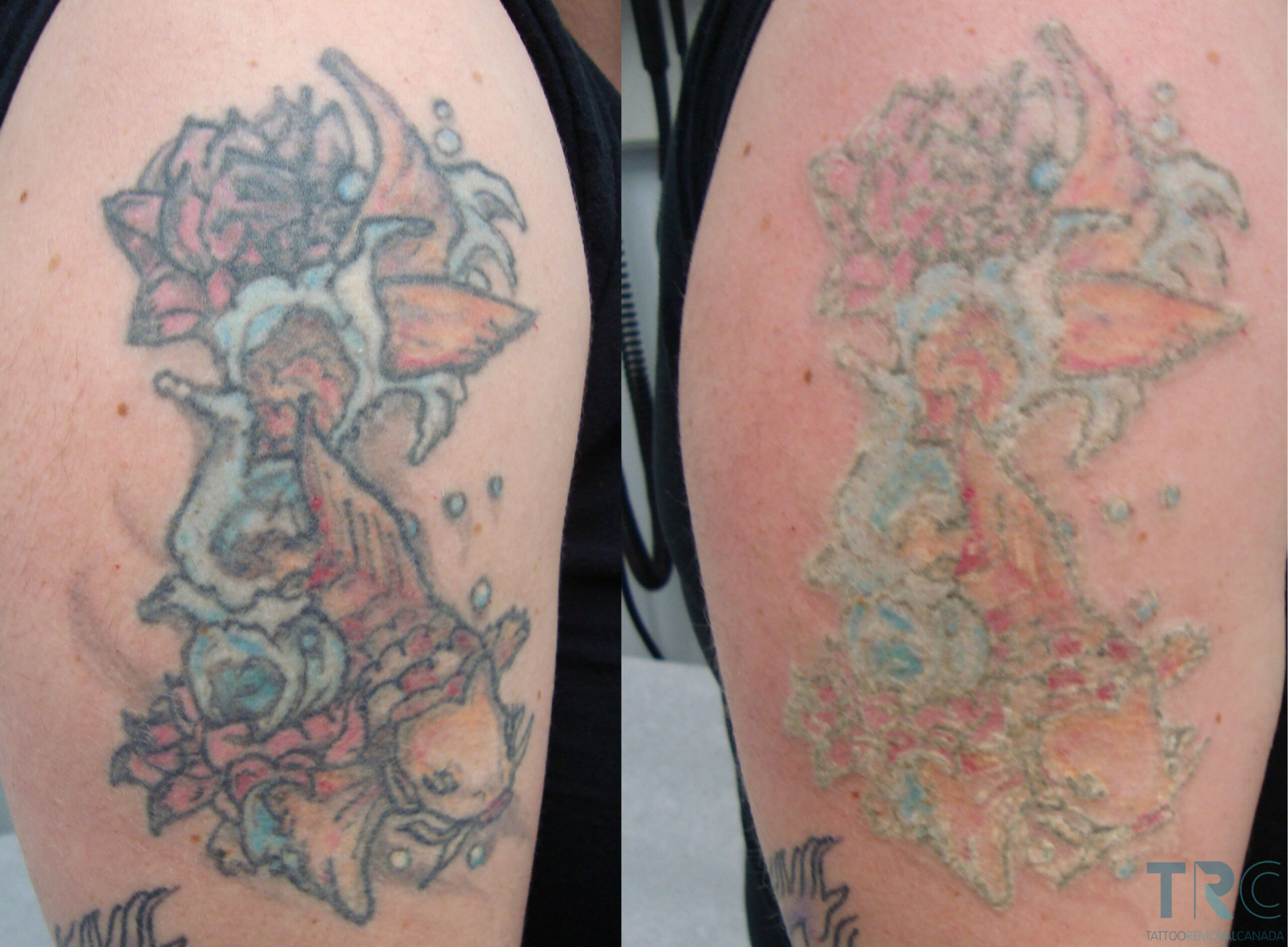 What tattoo colors fade